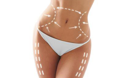 Injection lipolysis CHOJNICE